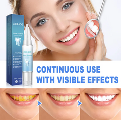 Eelhoe Tooth Repair Gel Repair Gum Deep Cleaning Oral Care Gel